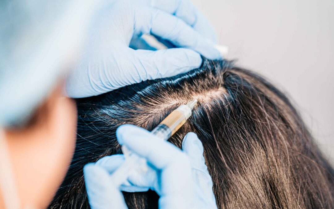 Exploring Non-Surgical Hair Restoration Solutions: What You Need to Know